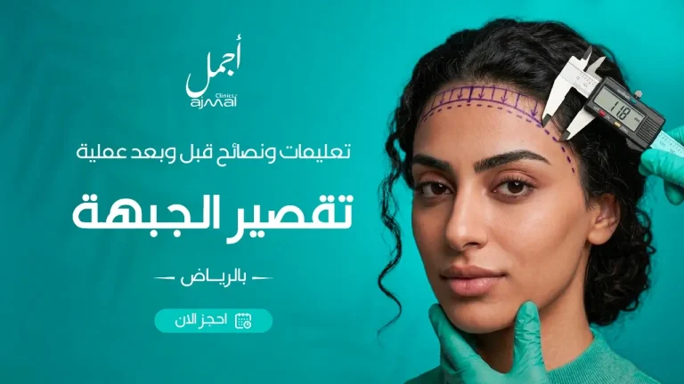تعليمات ونصائح قبل وبعد عملية تقصير الجبهة بالرياض